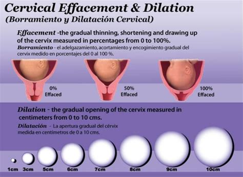A vaginal examination reveals that a client's cervix is 90% effaced and dilated to 6 cm. The fetus's head is at station 0, and the fetus is in a right occiput anterior position. The contractions are occurring every 3 to 4 minutes, are lasting 60 seconds, and are of moderate intensity.