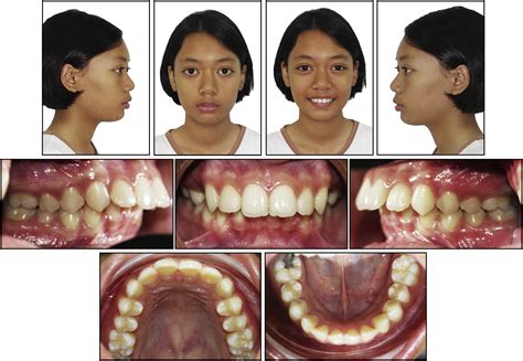 Image related to 2-div