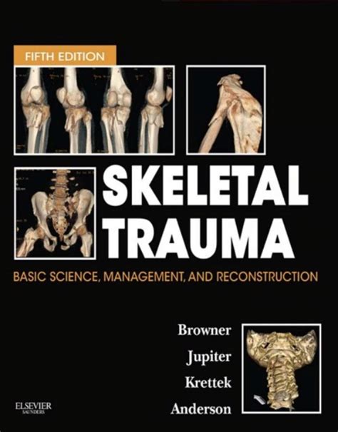 Full Download 2 Skeletal Trauma Springer 