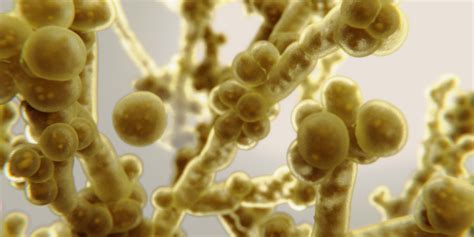 20 cases of Candida auris reported in San Diego area this year