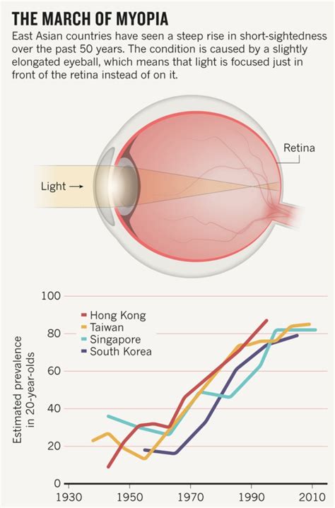 2015, Nature.com: "The myopia boom"