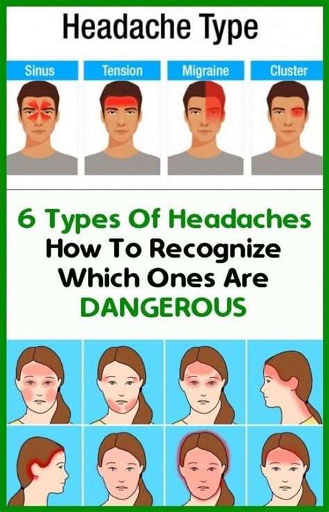 Identify headache