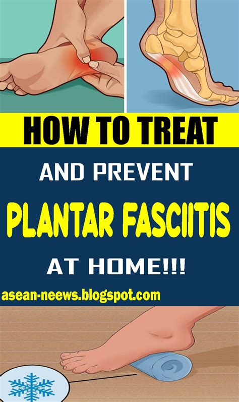 Plantar Fasciitis Treatment How to Stop Foot Pain symptoms or