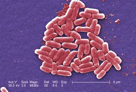 0157 82125129  coli 0157:H7 has been found in cattle, chickens, pigs, and sheep