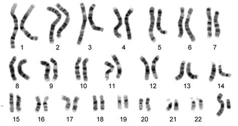 23 kromosom manusia  Pada autopoliploidi, n-nya mengganda sendiri karena kesalahan meiosis, sedangkan allopoliploidi, yaitu perkawinan atau hibrid antara spesies