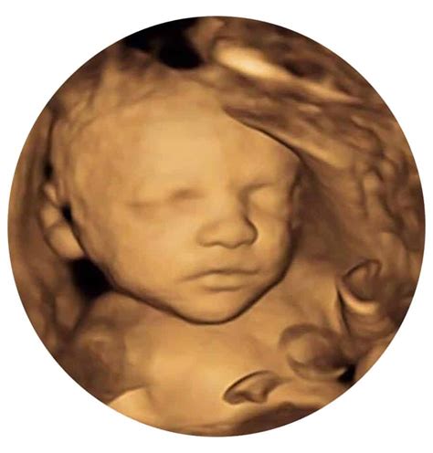 4d baby scan  582 people follow this
