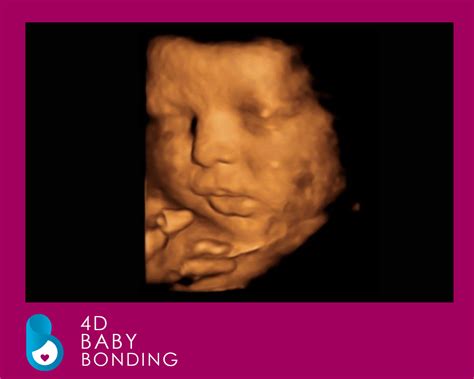 4d baby scan liverpool  Book