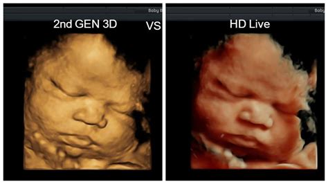 4d ultrasound yuma  You can avail discount from 0% - 50%