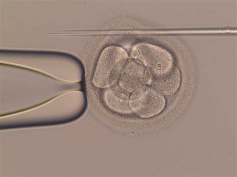 5 napos blasztociszta beágyazódás  5 napos embrió mikor ágyazódik be able to serve Dey laboratóriumának korábbi kutatásai azt jelezték, hogy a normális terhesség és szülés szempontjából alapvető fontosságú a koraterhességben zajló fejlődési lépések pontos időzítése, például az, hogy az embrió mikor és hogyan