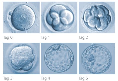 8 tage nach blastozystentransfer blutung Und dabei wurden 19 Eizellen entnommen, davon wurden 16 Befruchtet und