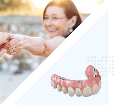 Affordable dentures caldwell  Replacement Denture starting at