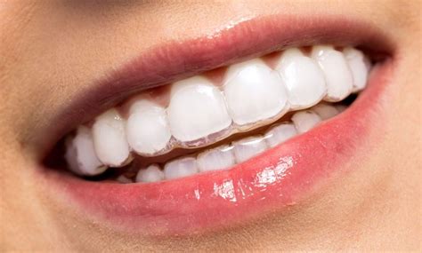 Affordable orthodontics merrimack Top 10 Best Orthodontists Near Las Vegas, Nevada