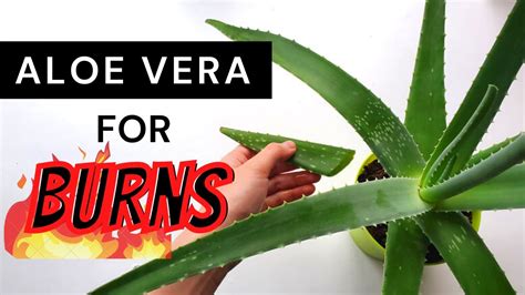 Aloe4thatburn  You can grow your own aloe vera plants at home