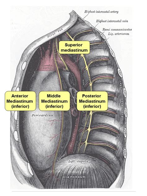 Aorta dan mediastinum superior tidak melebar  1