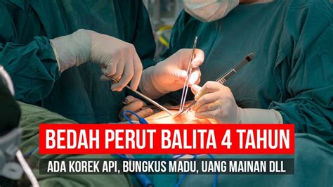 Arti mimpi operasi perut com