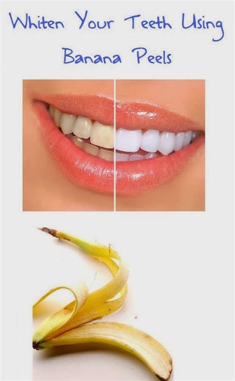 Banana peel teeth whitening hoax Unfortunately, there’s no evidence to suggest that banana peels really do whiten teeth