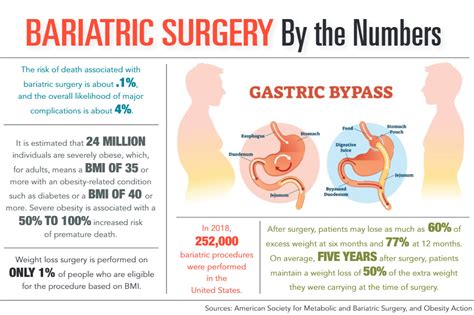 Bariatric surgery meadow woods 530 First Avenue, Suite 10S, Silverstein Elevators