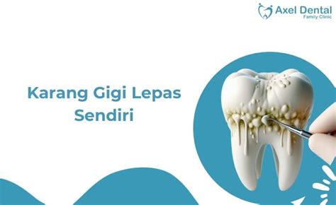 Bisakah karang gigi lepas sendiri  Memanfaatkan bahan alami yang tersedia di dapur Anda bisa menjadi solusi masalah karang gigi