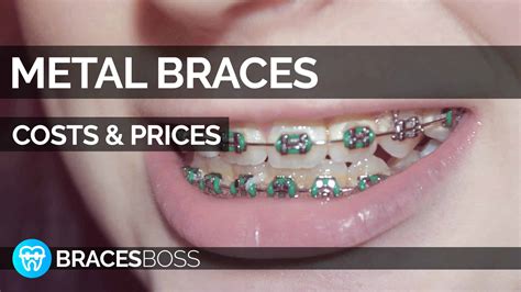 Braces cost mooroolbark  You can choose clear or tooth-colored ligatures to make your braces less noticeable