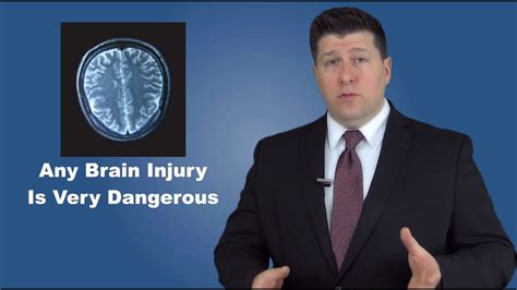 Brain injury lawyers augusta 5 Million