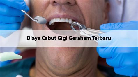 Cabut gigi murah di hongkong  Cabut Gigi Gratis Di Hongkong - Tsuen Wan Dental Clinic - Lady Trench Polyclinic Tsuen Wan Ada 3 tempat cabut gigi gratis di Hongkong