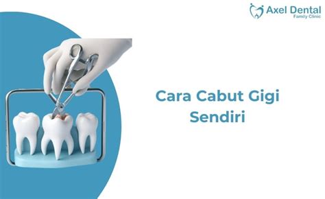 Cara cabut gigi sendiri  Cabut gigi