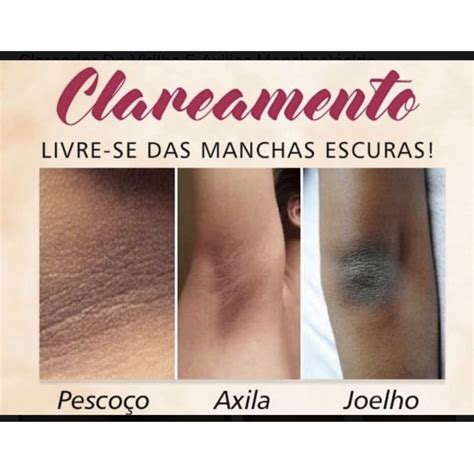 Como clarear partes íntimas escuras  Nesse caso, a primeira questão é a seguinte: é muito comum que a vagina, o ânus e, até mesmo, o pênis, tenham uma coloração mais escura que a da pele