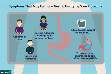 Cpt gastric emptying study Standardized scintigraphic study of gastric emptying of solids with consumption of a 320 kcal radiolabelled meal (scrambled eggs labelled with 99m Tc; Mayo Clinic protocol 30) and imaging over 4 h
