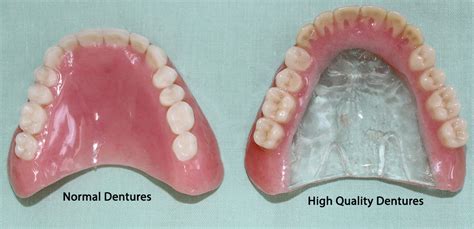 Custom made dentures canberra  For further