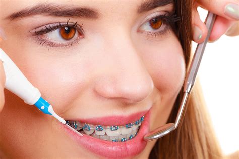 Dental braces ladysmith 1749 Heritage Trail, # 801, Naples, FL 34112