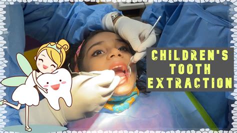 Dental extraction for children maple ridge  The number of appointments and time required, vary from patient to patient