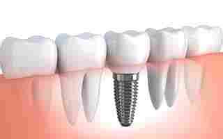 Dental implants weehawken nj  A dentist is trained to diagnose, treat, and prevent diseases of the gums, teeth, and jaw