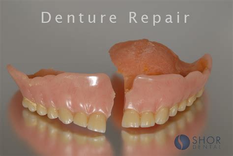 Denture repair kingscliff  When they are done soaking, dry them off and clean any excess materials off your denture