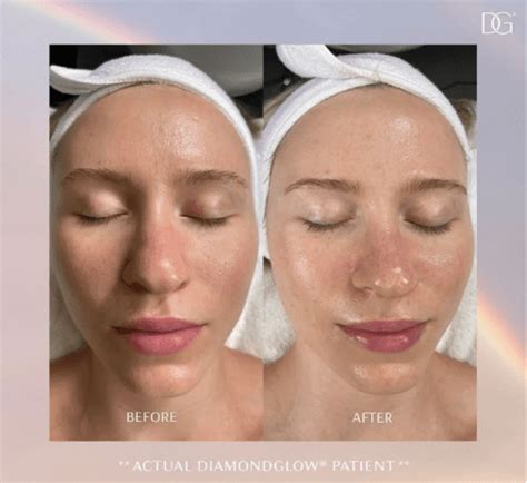 Diamondglow fall river The Solution For Healthy, Vibrant, Rejuvenated Skin