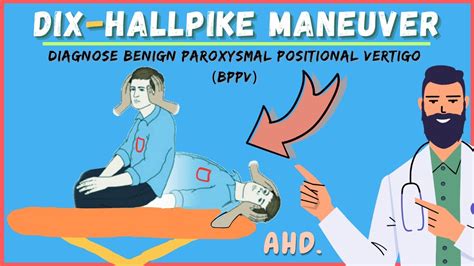 Dix hallpike maneuver youtube  This move can often bring on the vertigo and the doctor can observe to see