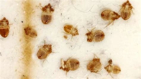 Does luxor have bed bugs  To add to your worries about bedbugs you might as well also start worrying about scabies