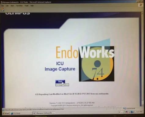 Endoworks software  Automated software accurately generates ERCP quality review