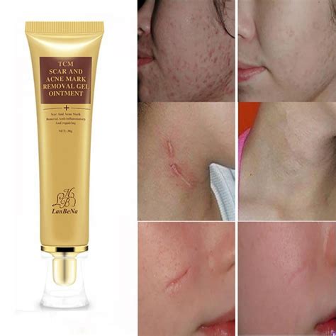 2024 Facial cleanser acne scar removal acne onlinesitem - Ð¿Ð¾Ñ€Ð½Ð°ÐµÑ„.Ñ€Ñ„