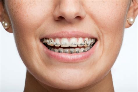 Fast orthodontics ballina 1 specialists FIND AN ORTHODONTIST < BALLINA < SMARTSMILE ORTHODONTICS: BALLINA Contact details Address: Specialists Dr Jude Antoniraj Dr Jude has completed