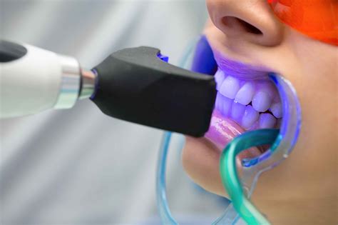 Fresh dental care eastex The average salary for Fresh Dental Care employees is around $93,234 per year, or $45 per hour
