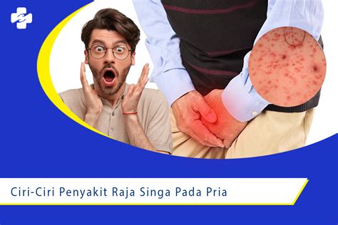 Gambar penyakit raja singa pada pria Penyakit menular seksual akibat bakteri: Beberapa jenis penyakit menular seksual yang disebabkan oleh infeksi bakteri adalah: 1