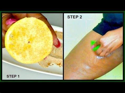 How to get rid of blackheads on inner thighs A painful bump or lump on the thigh can also appear red, small or large, and often be located on the inner thigh