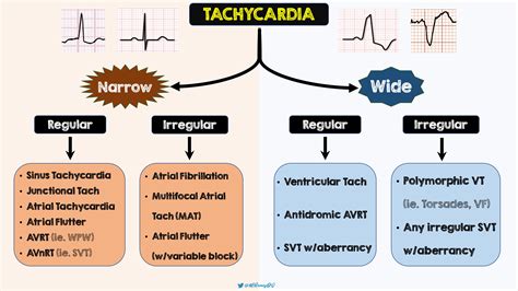 Icd 10 code for wide complex tachycardia  Abnormalities of heart beat (R00) Tachycardia, unspecified (R00