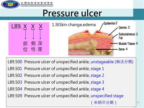 Icd-10 code for pressure ulcer right foot  2020 (effective