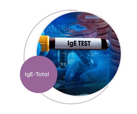 Ige total ערכים Total IgE levels were found to be associated with the prevalence of asthma, even in subjects without the presence of allergen-specific IgE (33, 34)