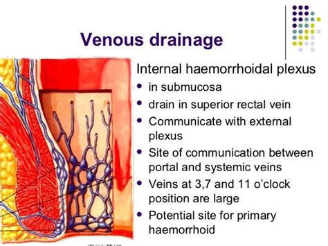 Internal hemroids Internal hemorrhoids typically do not cause any pain and do not require any treatment