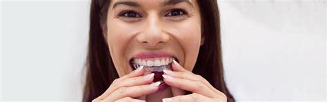 Invisible braces hinchinbrook Get Invisible Braces with Invisalign® Treatment in North York 