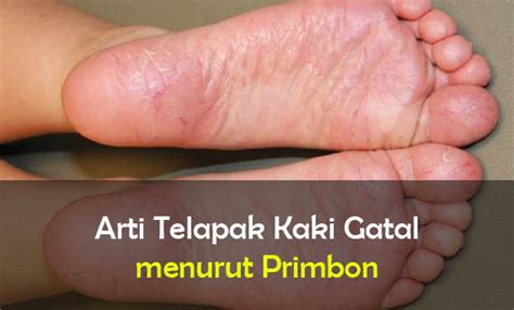 Kode alam telapak kaki kanan gatal  Mulai dari masalah yang ringan dan mudah diatasi, hingga serius