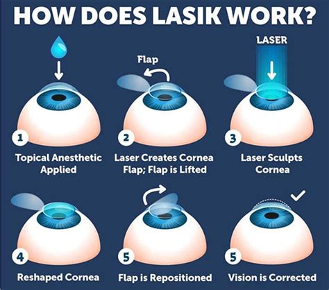 Lasik near graton  Find Reviews, Ratings, Directions, Business Hours, Contact Information and book online appointment