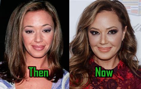 Leah remini plastic surgery Leah Remini does not appear to have aged a day since her debut into Hollywood through the sitcom, King of Queens